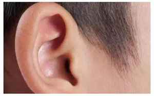 左耳发热是什么预兆男