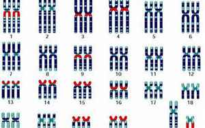无创dna18代表y染色体