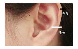 耳门长痣代表什么
