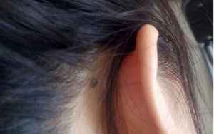 耳朵后面有痣代表什么(耳后根有痣代表什么)
