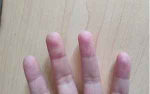 右手指尖发麻是什么病的前兆(右手指尖发麻是怎么回事)