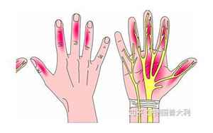 右手食指指尖麻木有大病预兆(食指尖麻木是什么征兆)